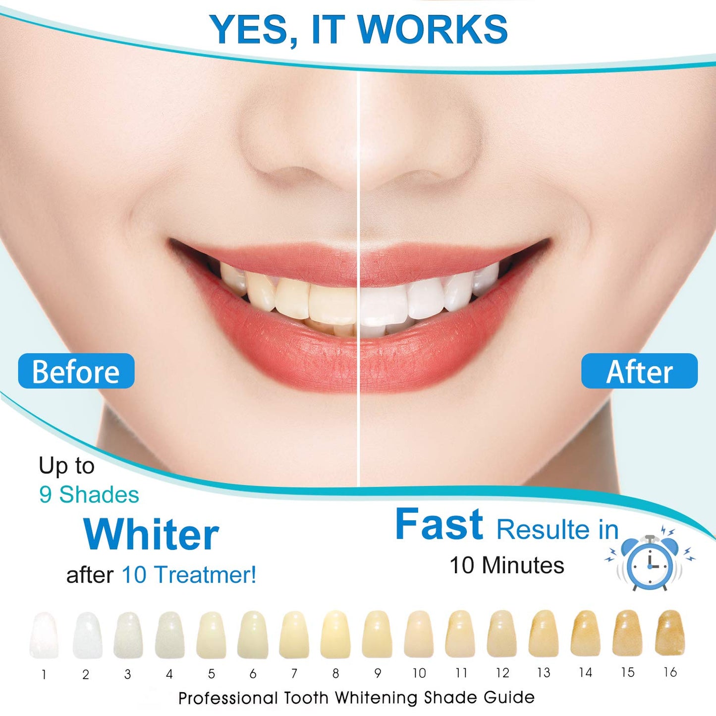  LED Teeth Whitener